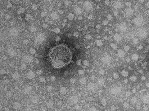 Pseudoscience: Ignorance about Borna Virus