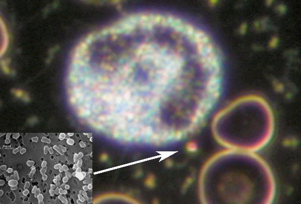 Nanobacteria Frequencies – always use when doing chelation