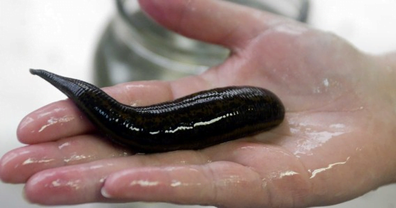 Parasites: Opening Up a Massive Frequency Database