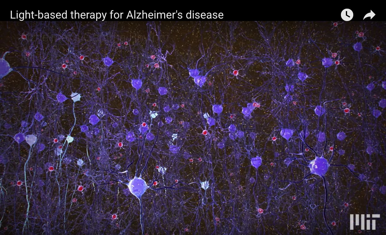 Alzheimers – Replacing the Missing Gamma Frequency