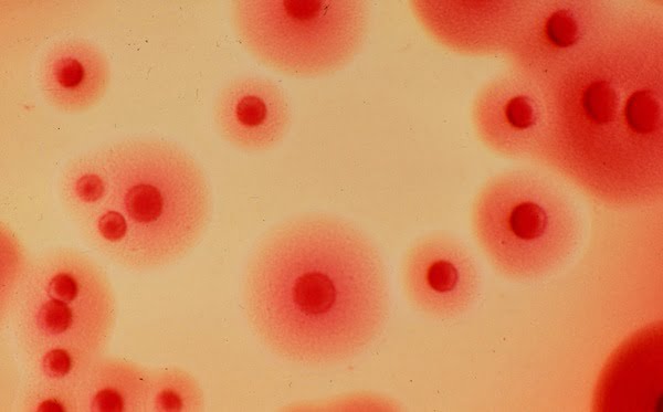 Mycoplasma Fementans Incognitus Frequencies Version 1.0