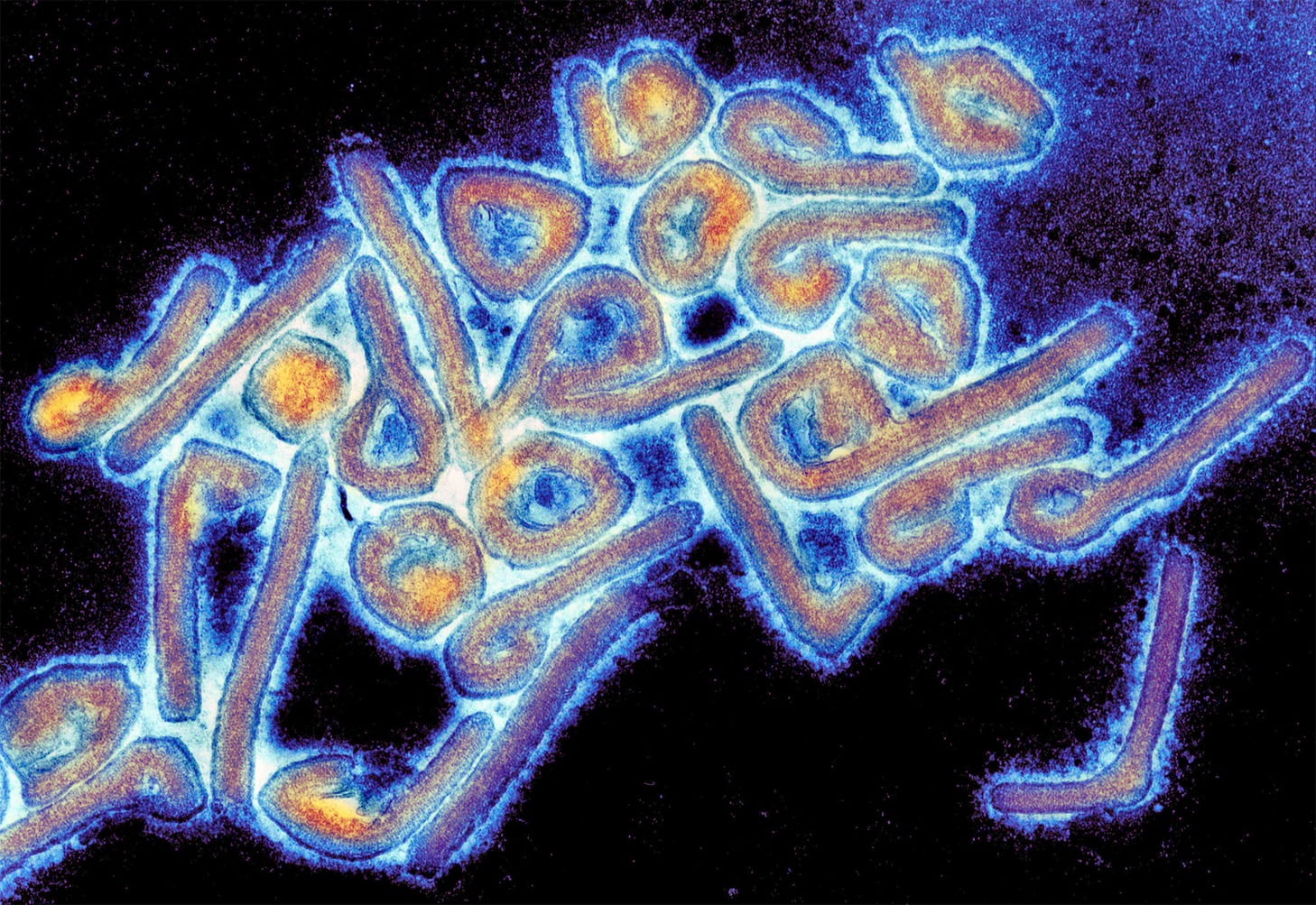 Marburg Virus