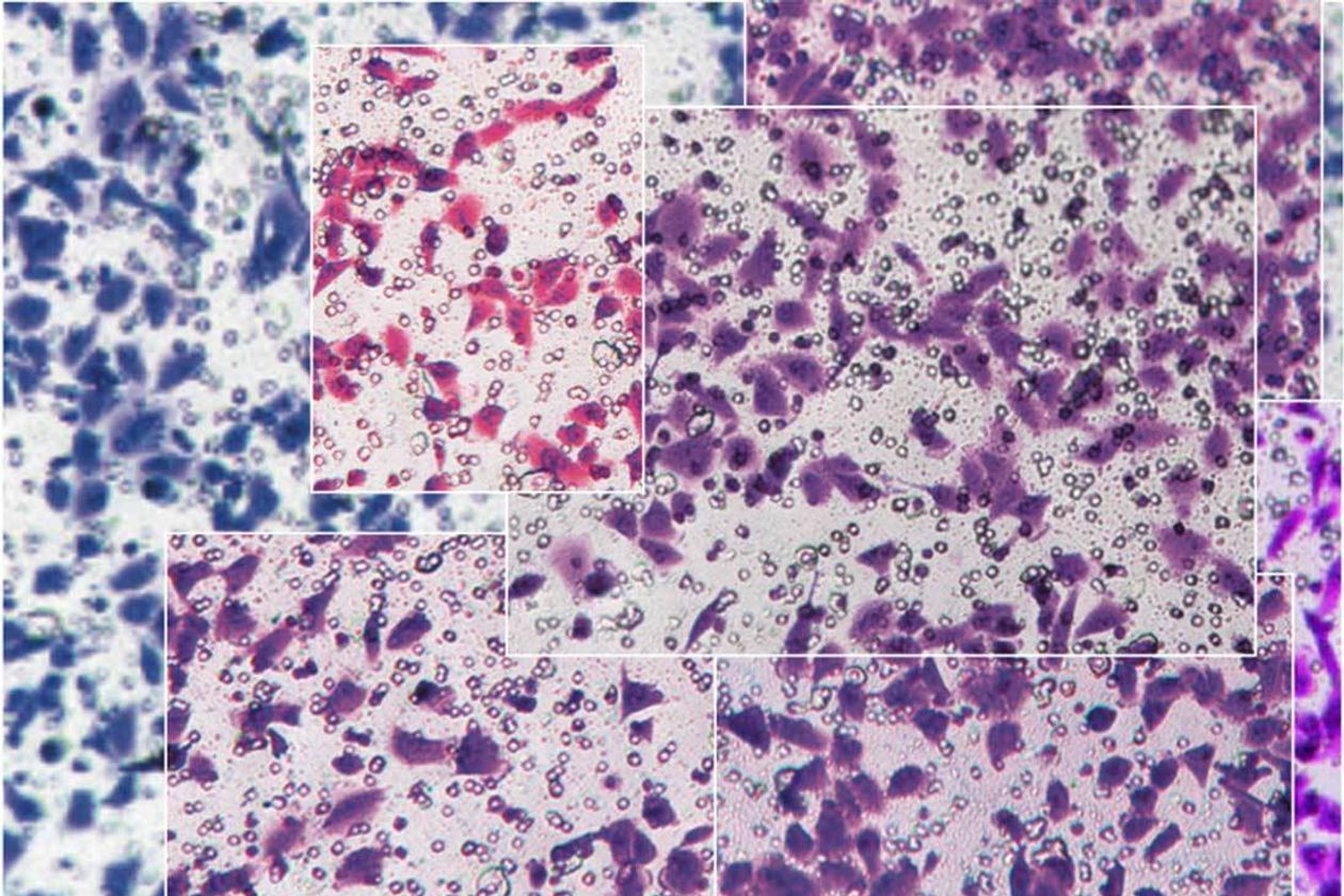 Pseudoscience: Fake Papers in Medical Journals