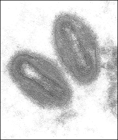 Monkey Pox